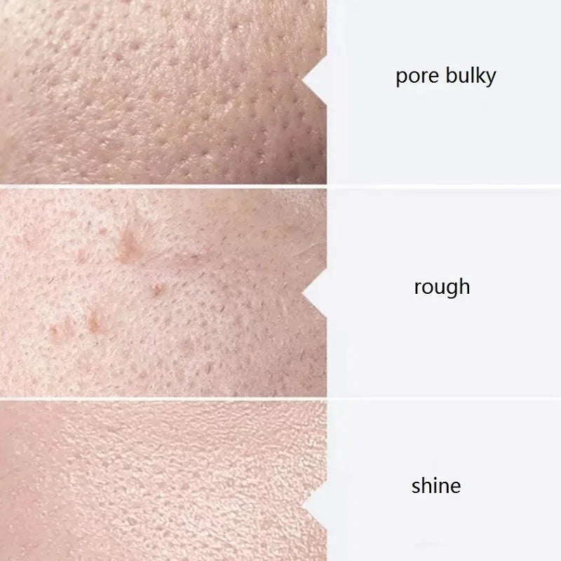 Aqua Peel Solution Serums