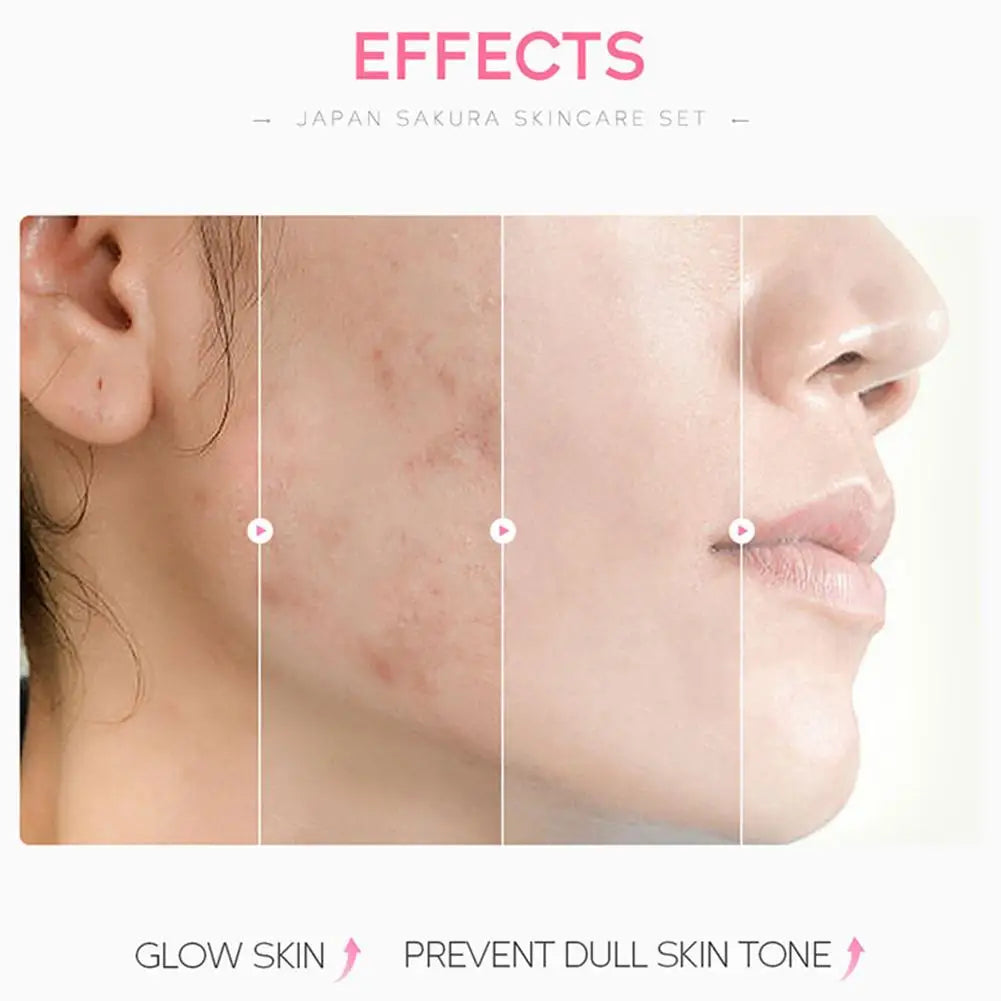 Sakura Skin Care Sets by LAIKOU